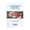 Alzheimer’s Disease