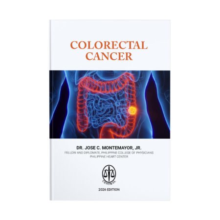 Colorectal Cancer